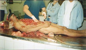Realizacion de una autopsia