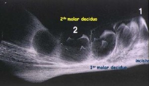 VI Curso de Avances en Odontologia Forense